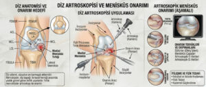 diz_artroskopi